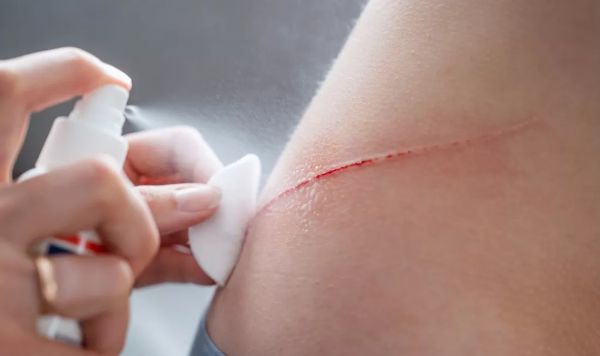 Военный спрей остановит любое кровотечение за одну секунду